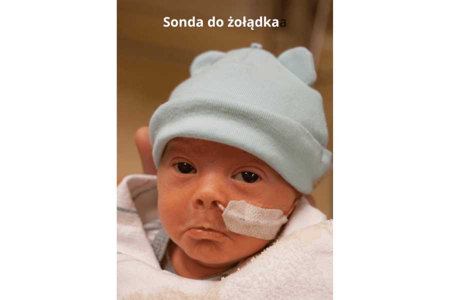 Noworodek z sondą do żołądka
